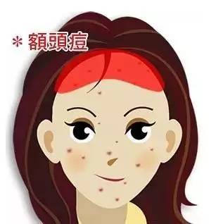 痘痘生长位置原因,痘痘长的位置代表什么要注意什么