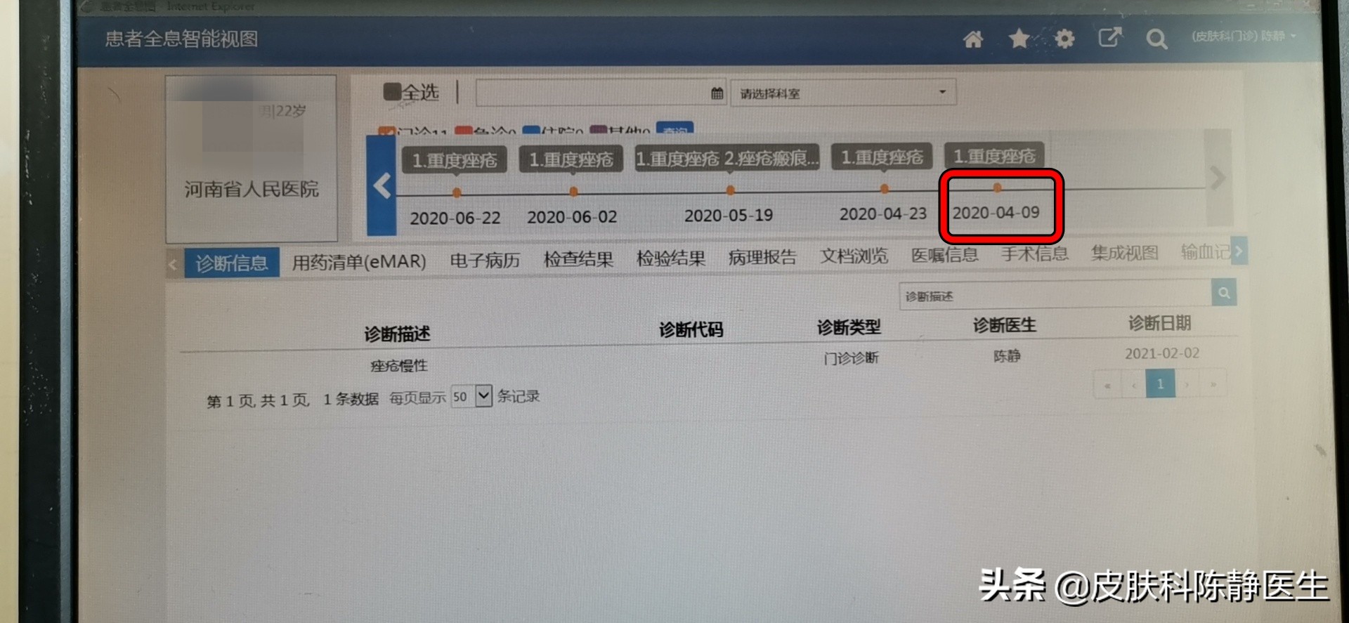 治疗脸部痤疮中医好还是西医好,传统治疗痤疮
