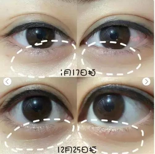 怎么挑选一款适合的眼霜,怎么选择一款适合自己的眼霜