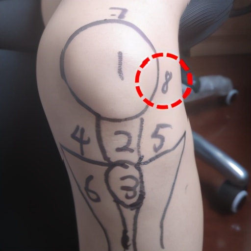 不同部位膝关节,骨科医生教你一招搞定膝盖痛