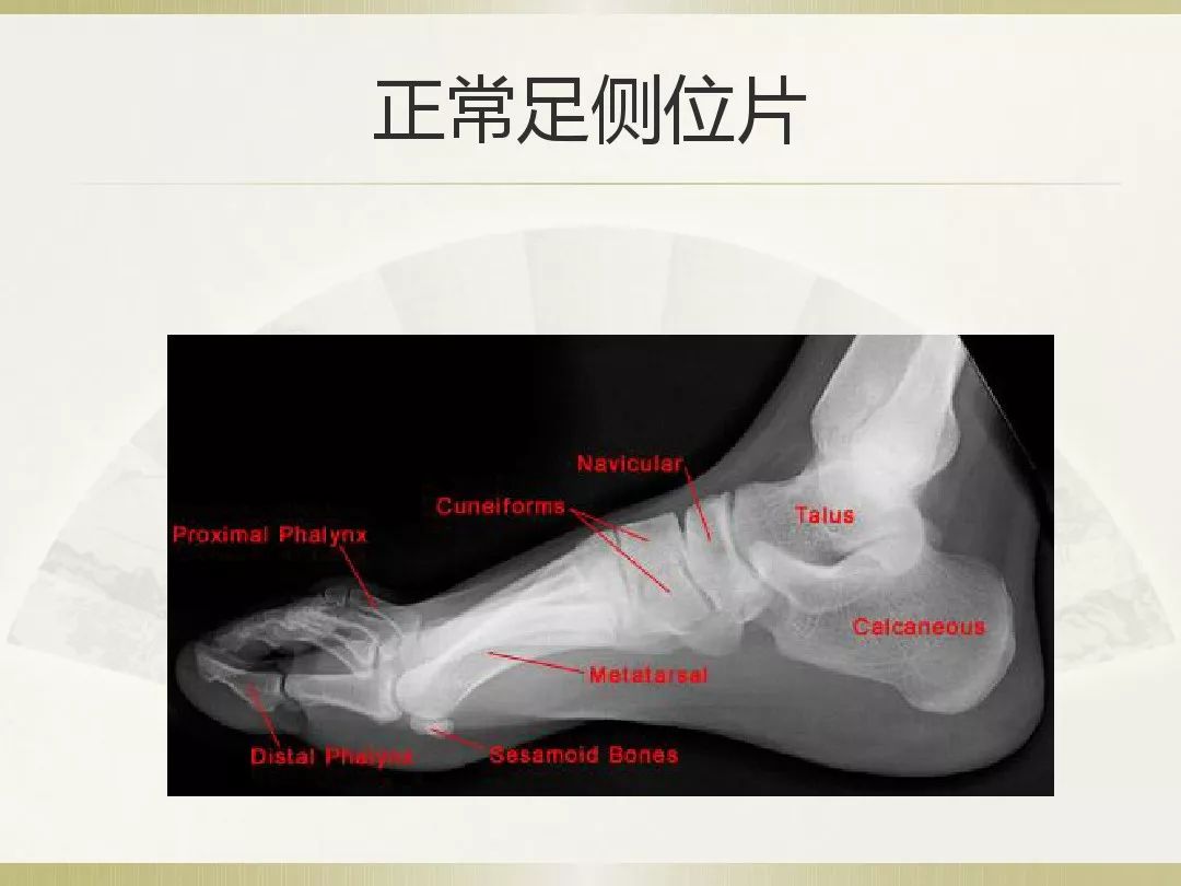 骨科x光片读片技巧,放射科骨科读片教程