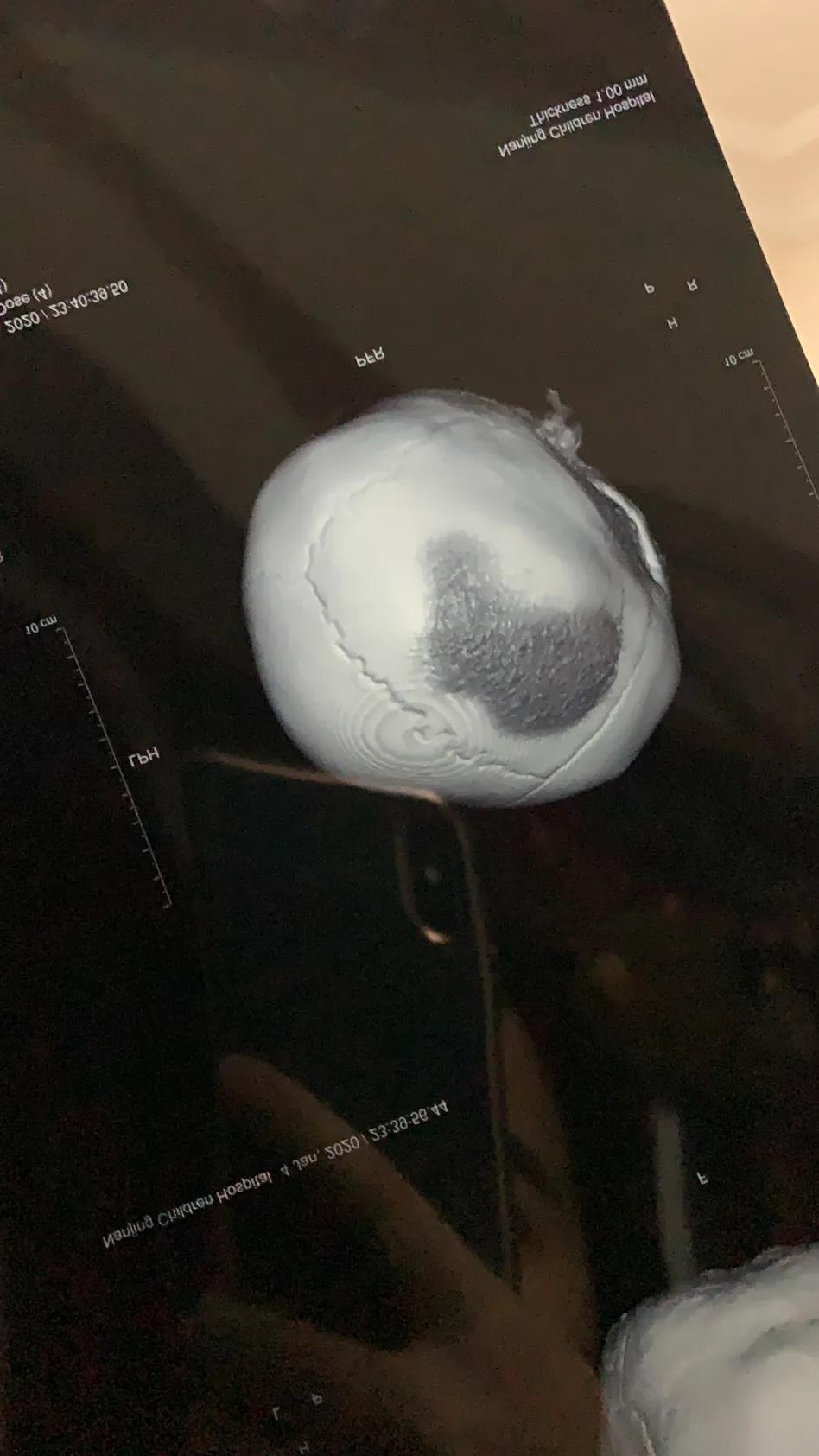 婴儿掉床有什么办法,如果宝宝掉床怎么办