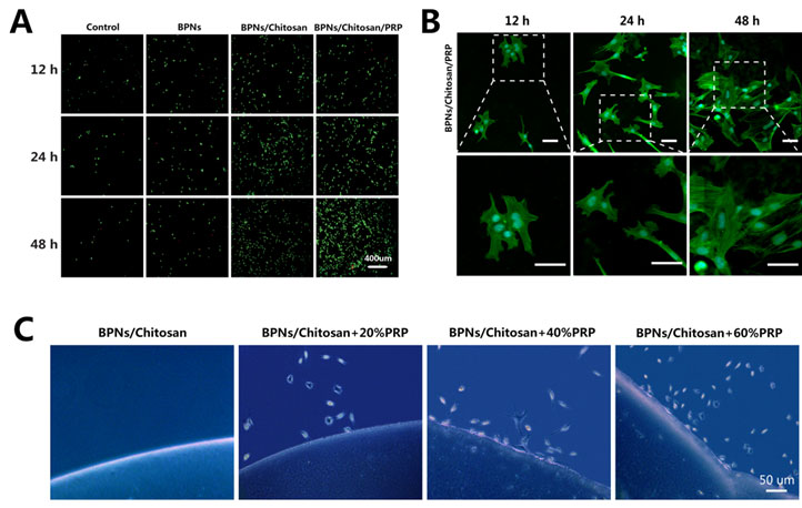 基于黑磷纳米片的多功能温敏水凝胶系统治疗类风湿