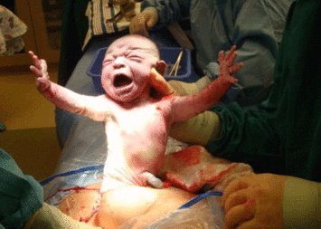 疤痕子宫的宝妈，几周可以剖宫产？产科医生告诉你