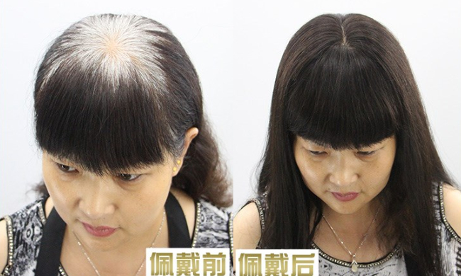 白发越来越多吃什么可以改善,白发越来越多有什么好办法