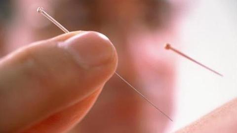 选择专业前你要知道的事,针灸的入门基础知识