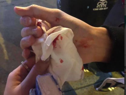 澳大利亚华人留学生被暴打,澳大利亚大学华人学生被打事件