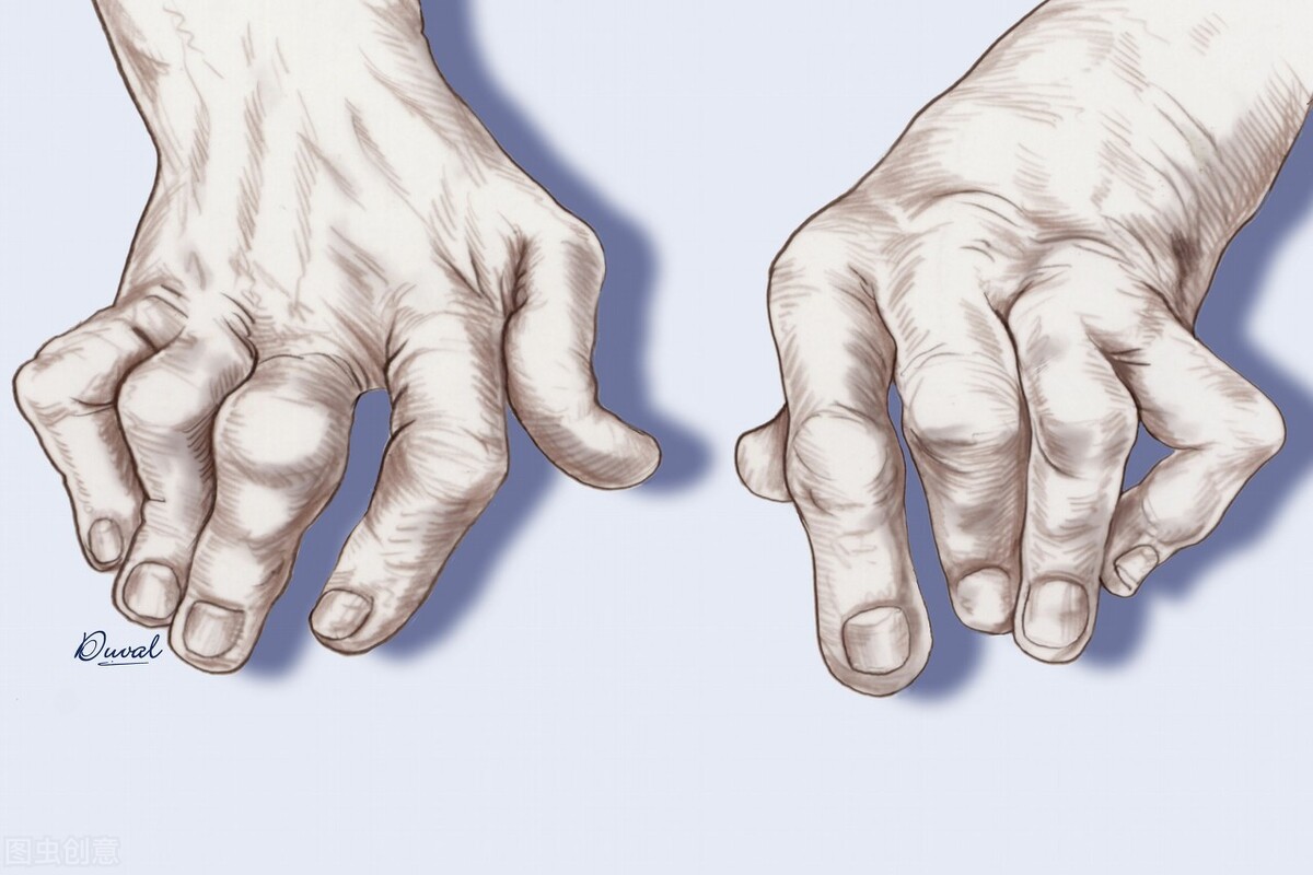 中医说痛风辨证分型,专家讲解痛风急性发作期治疗