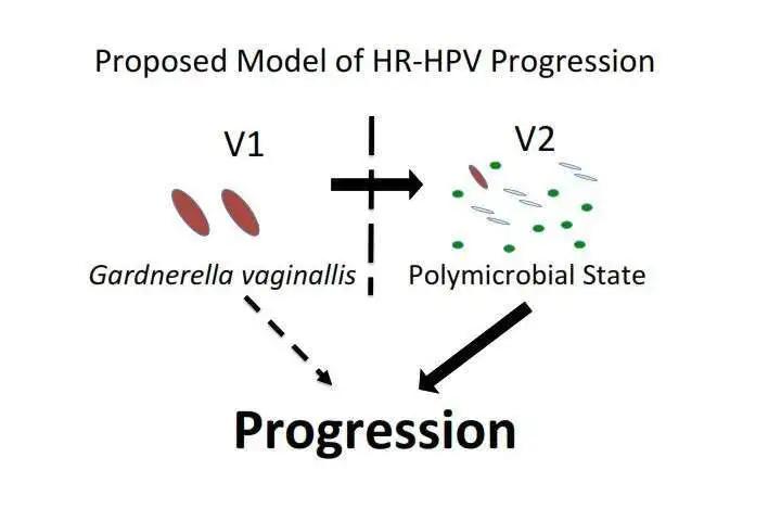 不用检测HPV，只用鉴定微生物组或可预测感染HPV前期癌症风险
