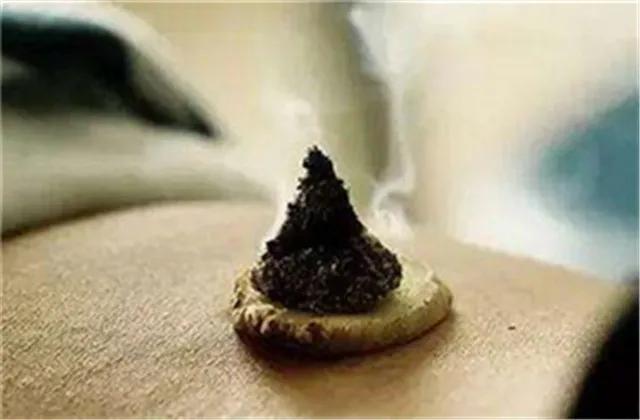 灸法大全,各种病症都应该灸哪些穴位