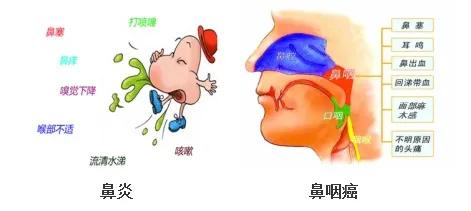鼻炎、鼻癌、鼻咽癌，还在傻傻分不清？