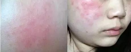 濂界墿娼祦鏉ヨ,鑳跺師鎶楄“绮惧崕