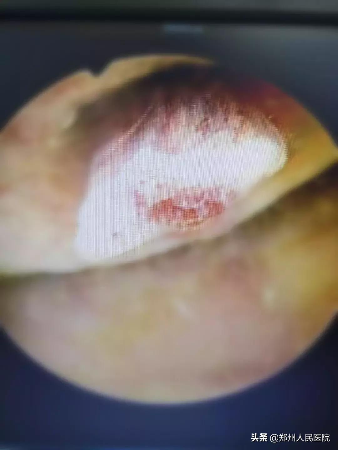 怀孕了经常出血是啥情况,怀孕了经常出血怎么回事