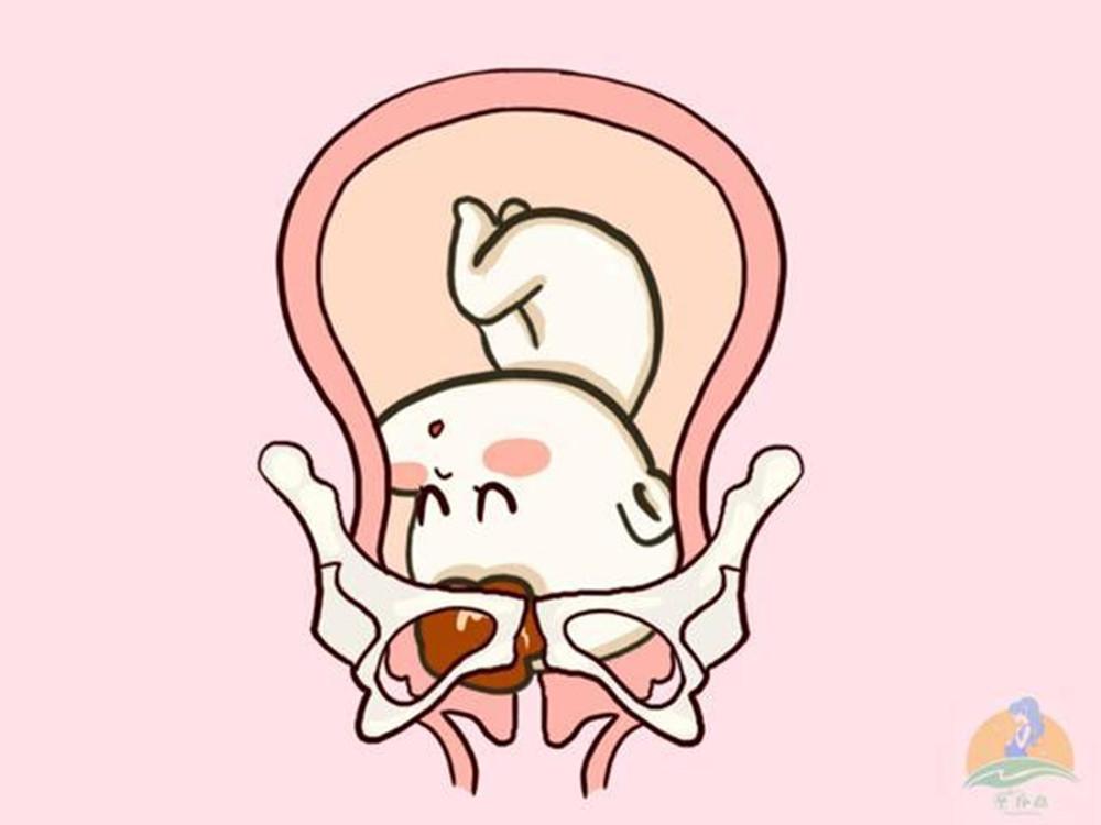 胎位不正怎么纠正最快注意事项,胎位不正怎么纠正最快海南