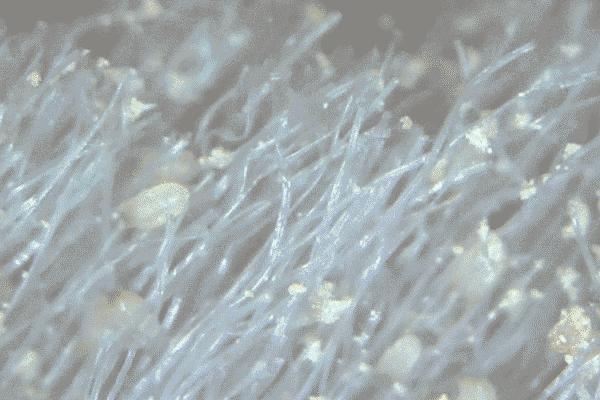 爱长痘的人一直长痘,爱长痘痘的皮肤