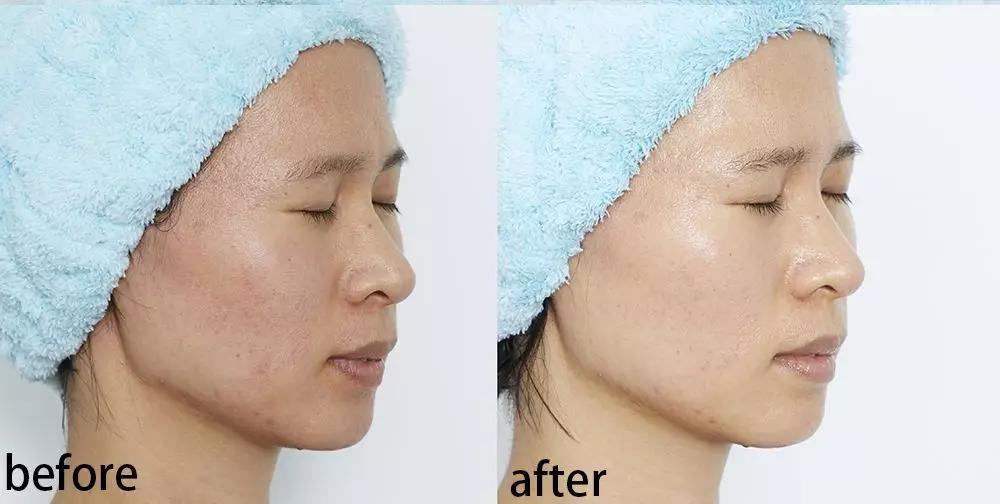 真人改造|不靠医美，一天实现“换皮”