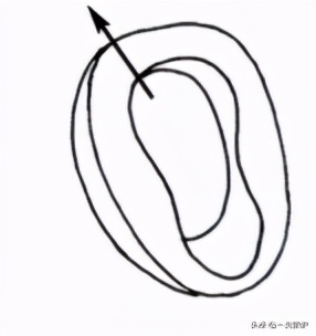 男老人卧床大小便怎么处理,如何护理大小便失禁的卧床老人