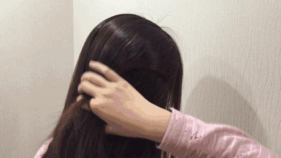 头皮屑严重如何处理好得快,头皮屑多是什么原因到底该怎么治