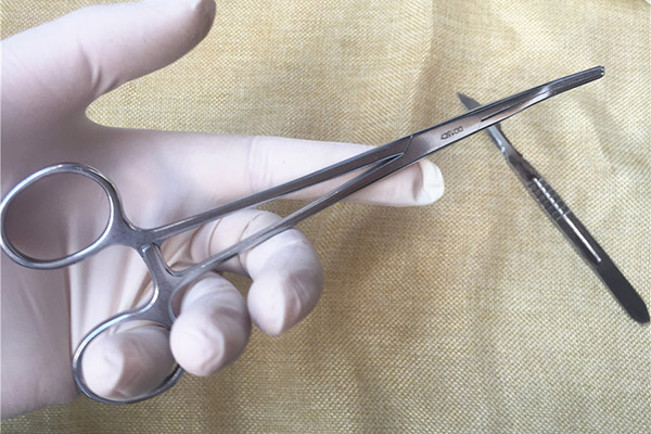 手指上有包一按就疼怎么办,手指上有小包一碰就疼是怎么回事