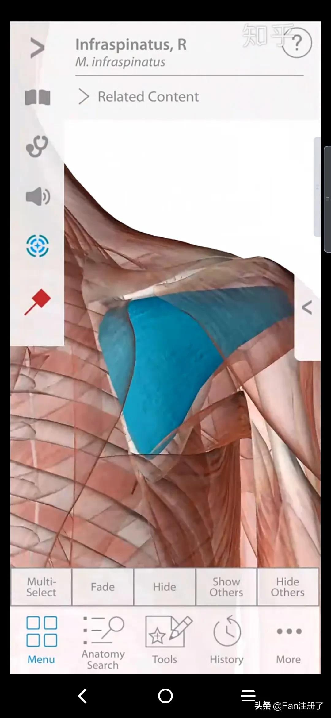 肩痛肩袖损伤针刀治疗,肩痛肩关节活动受限用什么药