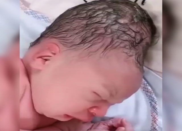 分娩时婴儿头部挤压怎样恢复,分娩时宝宝脑袋被挤压变形