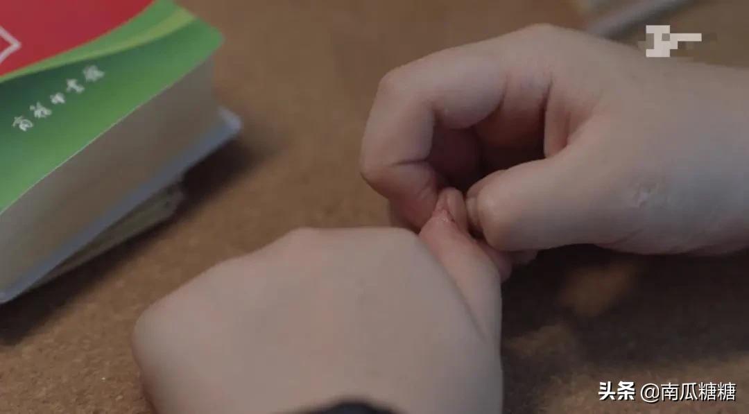 小孩抠手指头皮是缺什么,小孩儿总抠手指头是缺哪种维生素