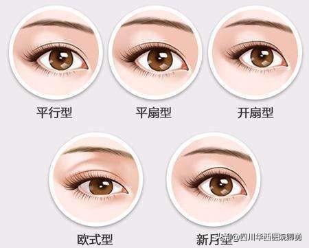 眼部整形的最佳标准,眼部整形可以整成圆眼吗