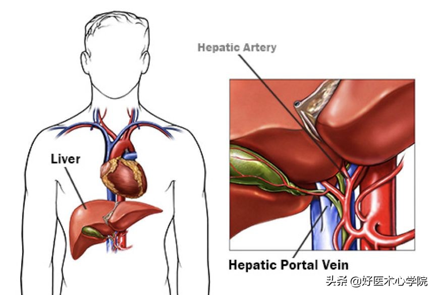 最常见的血栓类型是,最致命血栓视频