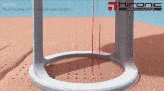 激光美容的12个误区一定要记清,激光美容的正确方法