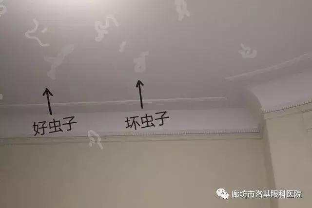年龄大了飞蚊症恢复最简单,年纪轻轻得了飞蚊症