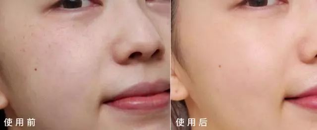 火到断货的“明星级”点斑笔,坚持每天点一下,14天养成初恋脸