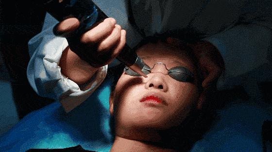 揭秘改善红血丝的四大方法,5个小妙招彻底告别红血丝