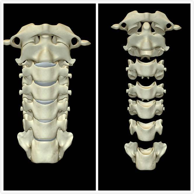 腰间盘突出颈椎病怎么彻底治愈,颈椎病能不能完全治愈