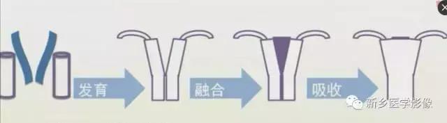 常见的几种子宫畸形诊断标准,先天性子宫畸形是什么原因造成的