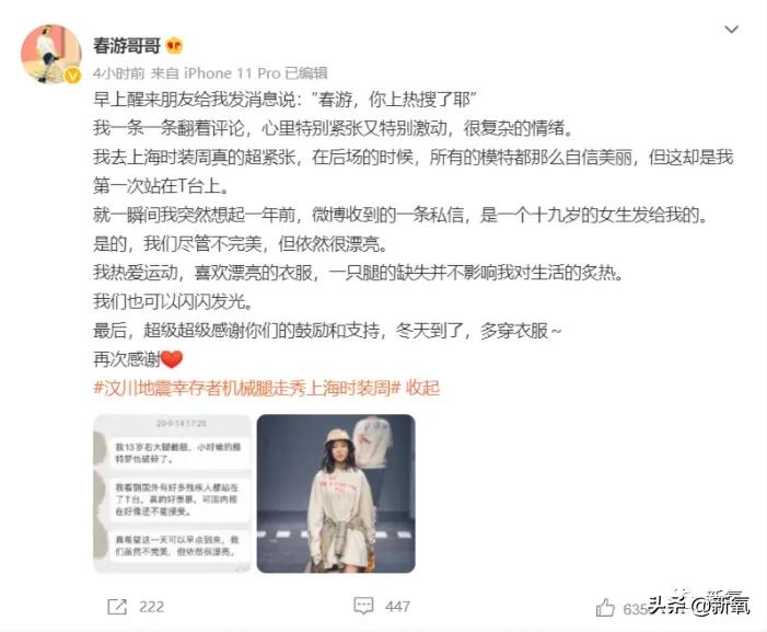 连​她也要被质疑靠腿炒作？