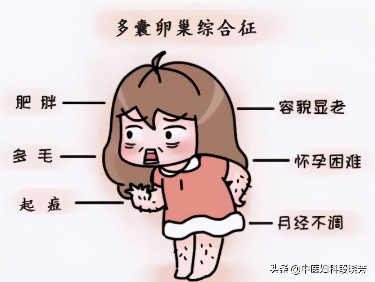 中医段晓芳治多囊贵吗,段晓芳治疗多囊卵巢