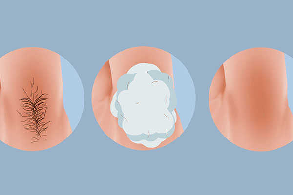 腋毛剃了多久长出,医院剃腋毛多少钱