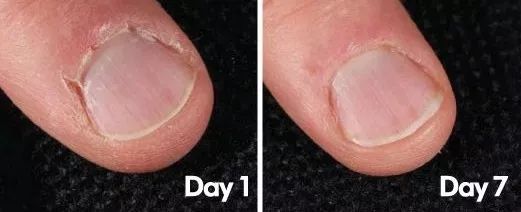 手脚皮肤干裂怎样快速保湿,缓解手脚干裂的小妙招