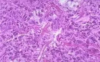 女性阴道炎怎么办?做好这些事,远离难“炎”之隐