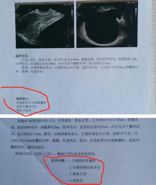 继发性不孕怎么治好,继发性不孕怎么治疗最有效