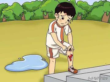 血友病的症状是什么,血友病的发病特点是