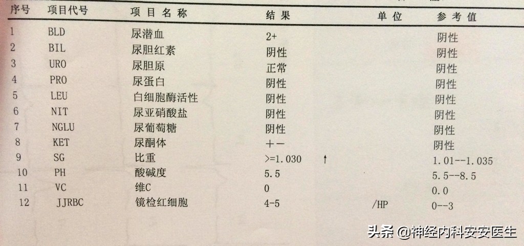 产后手脚浮肿是什么原因,手脚面部浮肿是什么原因