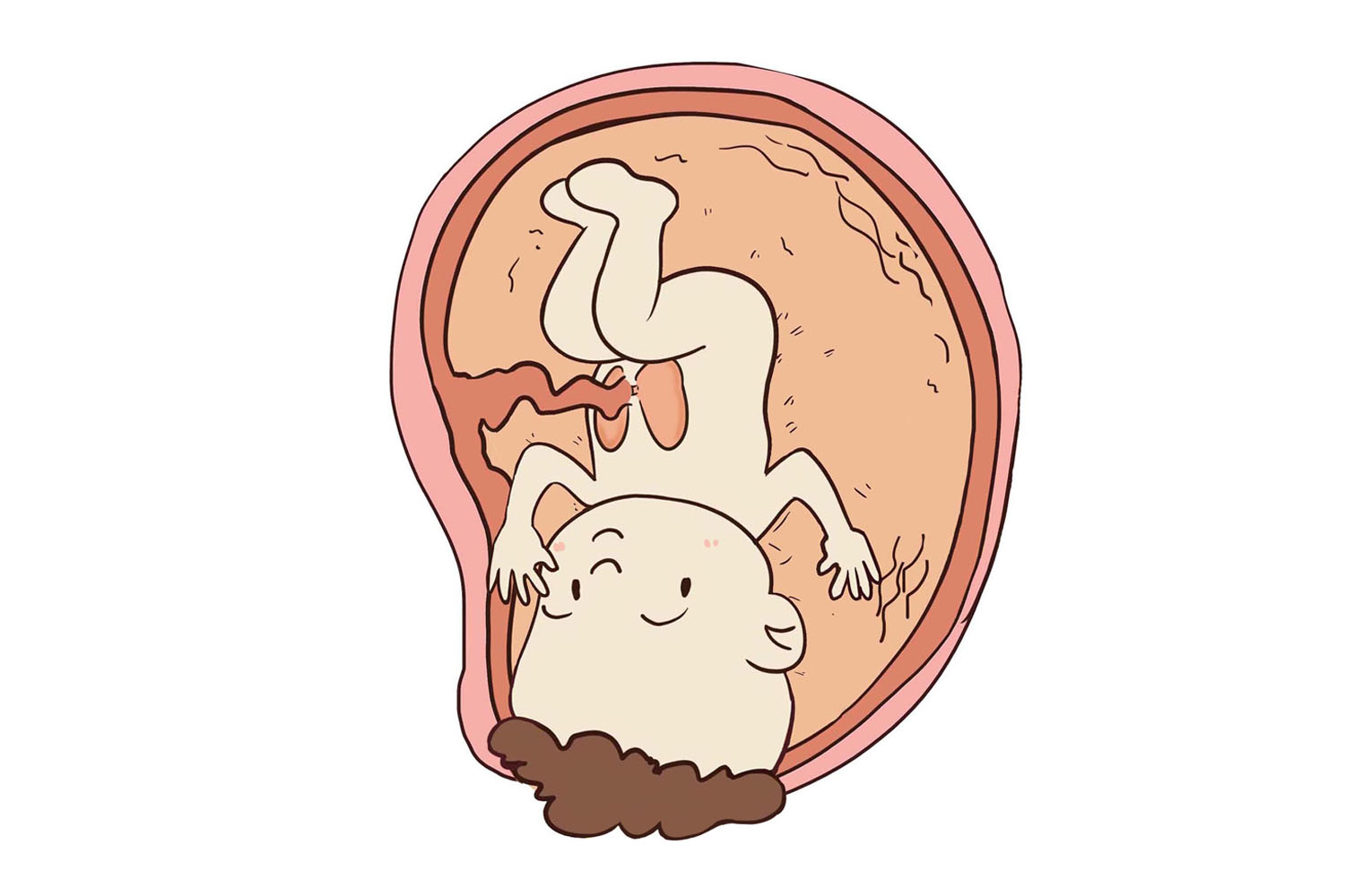 女人分娩为什么要侧切,女人分娩为什么需要接生