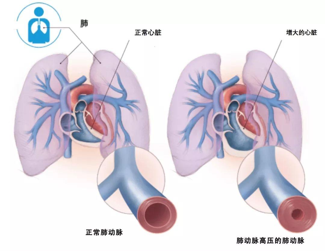 国产伟哥哪个牌子好副作用小,国产伟哥正确吃法和作用