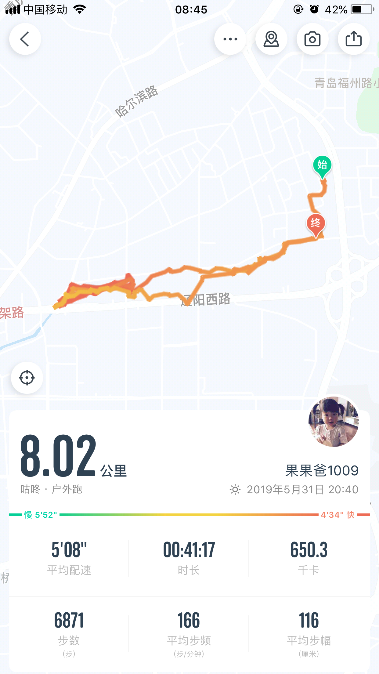尿毒症透析患者日常分享,尿毒症患者的透析日常
