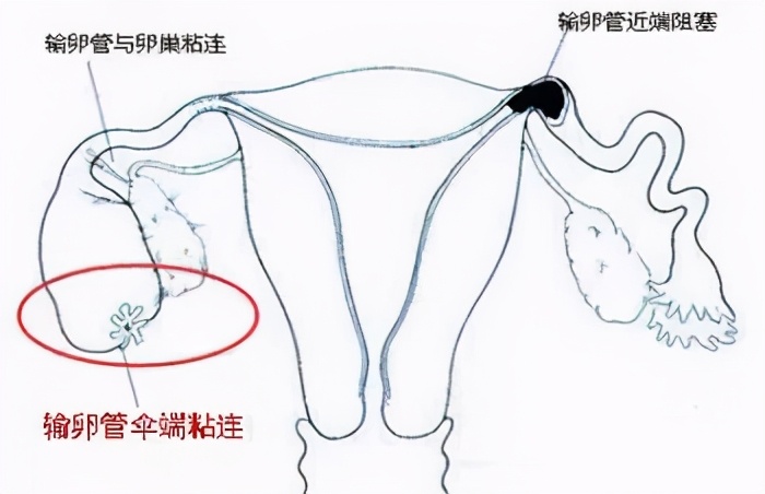 这3类病症或是祸首,这三种病其实都属于癌前病变