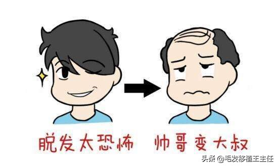 早期遗传性脱发就认命了吗,遗传性脱发是不是只能植发了