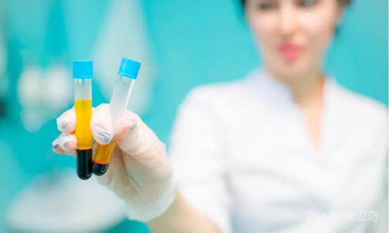 德国和美国发明治新冠肺炎药,德国如何防新冠肺炎