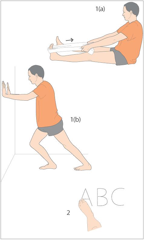 扁平足手术,扁平足锻炼