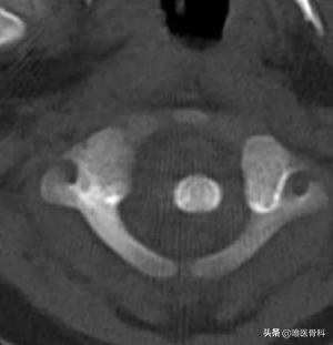 孩子轻微感冒怎么提前预防,医生小孩感冒一般怎么处理